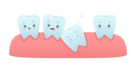 Dent impactée de dessin animé dans la gencive Impaction des dents