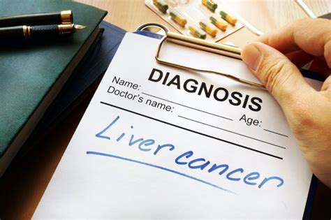 A Guide To Liver Cancer Diagnosis Birmingham Gastroenterology Associates