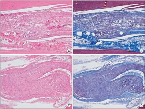 Photomicrographs Showing The Longitudinal Sections Of The Sciatic