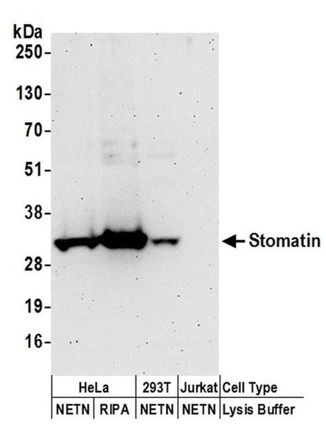 Stomatin Polyclonal Antibody A304 425a