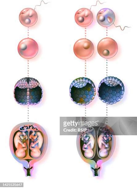 Human Embryo Twins Photos and Premium High Res Pictures - Getty Images