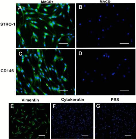 Immunocytochemical Staining Of PDLSCs The MACS Positive Cells Showed