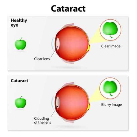 Cataracts In Dogs 5 Ways To Prevent And Treat Them Top Dog Tips