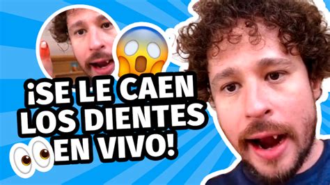 ¡se Caen Dos Dientes En Vivo Caso Impactante De Luisito Comunica