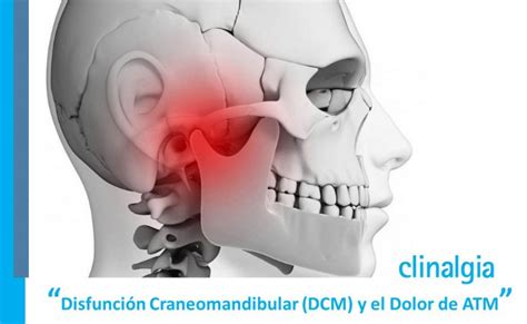 Disfunci N Craneomandibular Dcm Y Dolor Atm