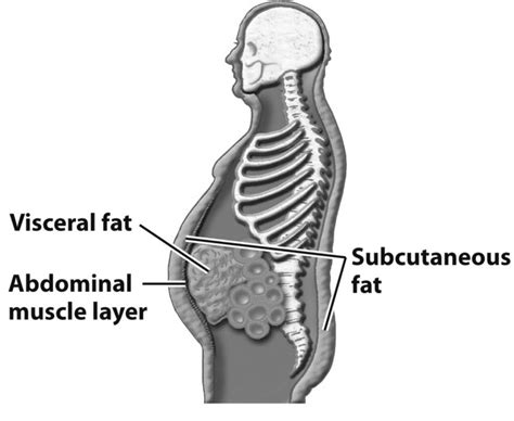 How To Lose Belly Fat... (Especially For Obese Indians)