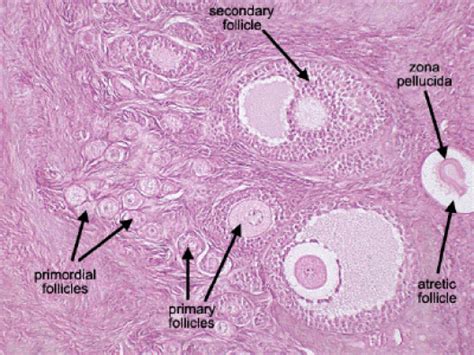 Primary And Secondary Follicles Medicine Medicine Notes Medical