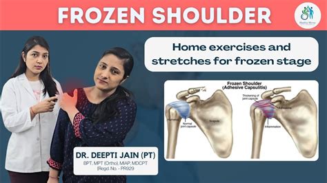 Frozen Shoulderexercises And Stretches For Frozen Stage Adhesive