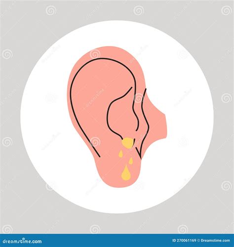 Fluid Draining from the Ear. Otitis, Tinnitus Symptom. Bacteria in the ...