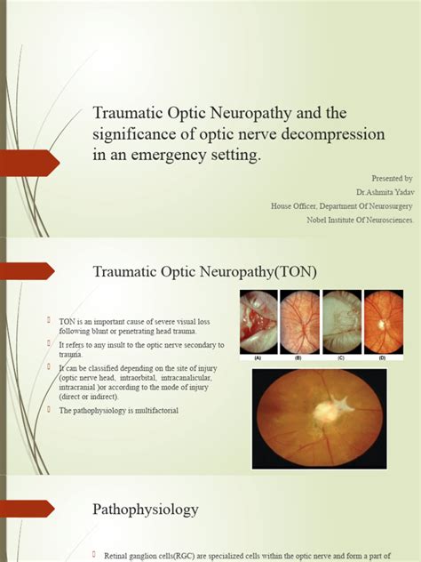 Traumatic Optic Neuropathy and The Significance of Optic | PDF | Injury | Surgery