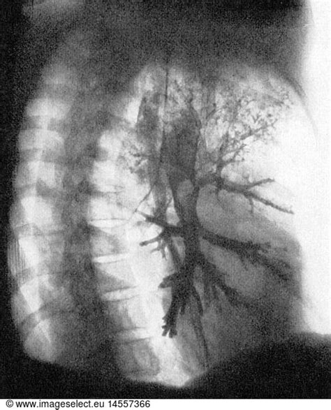 Medicine Medicine Irradiation X Ray Measurement Recording Of The