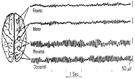 EEG Signals of Emanating from Lobes of the Brain (Source: Richard and... | Download Scientific ...