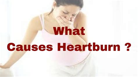 Heartburn Symptoms What Causes Heartburn Heartburn Remedy Youtube