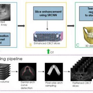 Cbct Reconstruction Using Super Resolution A Flattened Cbct Synthesis