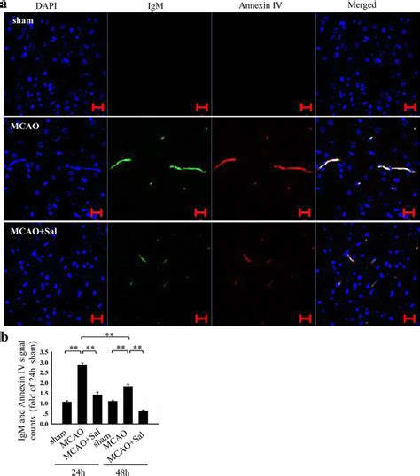 Salidroside Prevents Increases In IgM And Annexin IV Caused By Cerebral