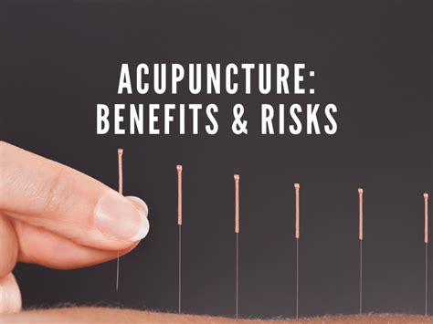 Acupuncture: How it works, Benefits, and Risks