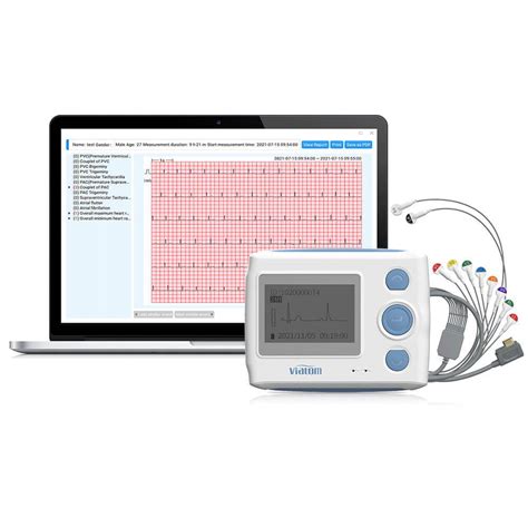 ECG Monitors Wellue