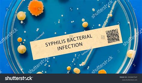 156 Syphilis Rash Images, Stock Photos & Vectors | Shutterstock