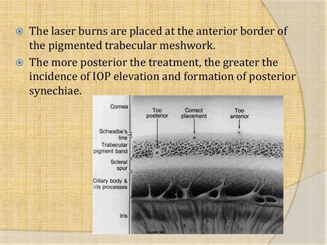 Argon laser