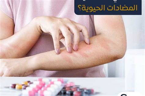 ما هي حساسية المضادات الحيوية؟ هيئة الدواء توضح