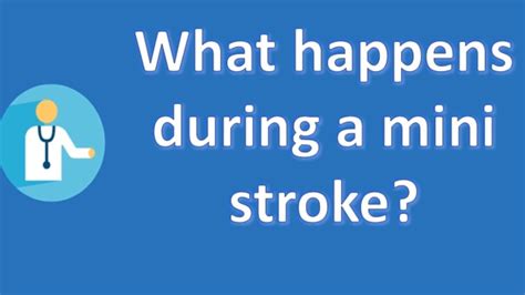 What Happens During A Mini Stroke Most Asked Questions On Health