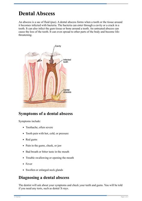 Text Dental Abscess Healthclips Online