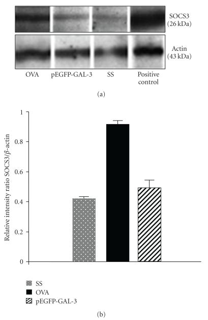 Western Blot Of SOCS3 A Protein Extract From Lungs Was Separated By