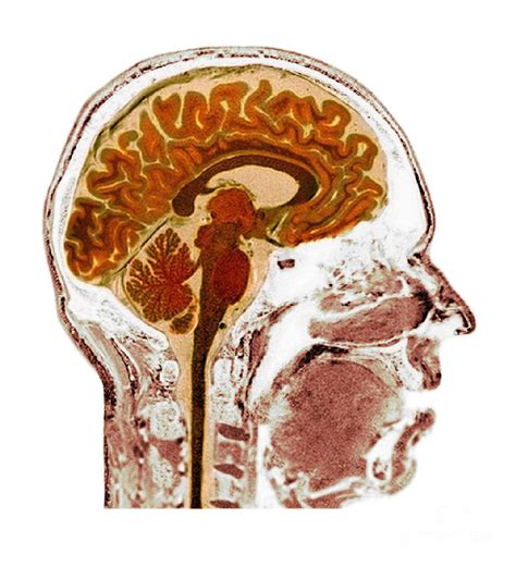 Normal Human Brain Mri Scan Photograph By Du Cane Medical Imaging Ltd