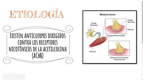 ENFERMEDAD DE MIASTENIA GRAVIS MEDICINA FISICA DEFINICION ETIOLOGIA