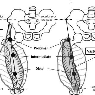 Ultrasonographic Measurement Sites On The Rectus Femoris A And Vastus