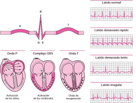 Electrocardiograma Normal Corazon Electrocardiograma