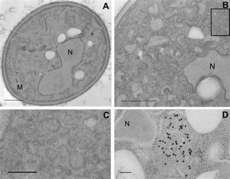 Morphological Analysis Of S Cerevisiae Pex19 Cells Overproducing