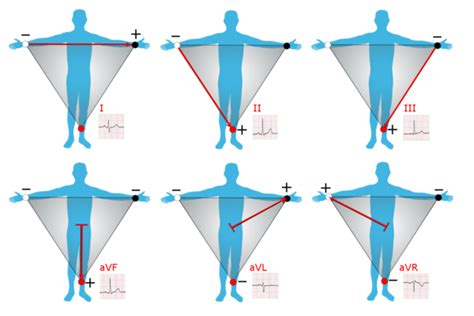 Electrocardiography Wikipedia The Free Encyclopedia Ekg Triangle