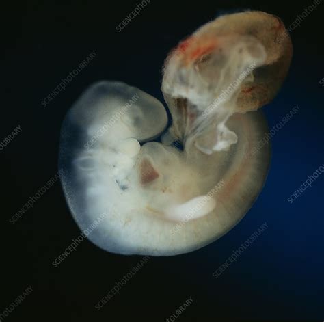 Human Embryo 4 Weeks