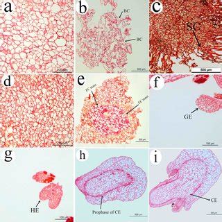 Starch grains staining during somatic embryogenesis in O. henryi ...