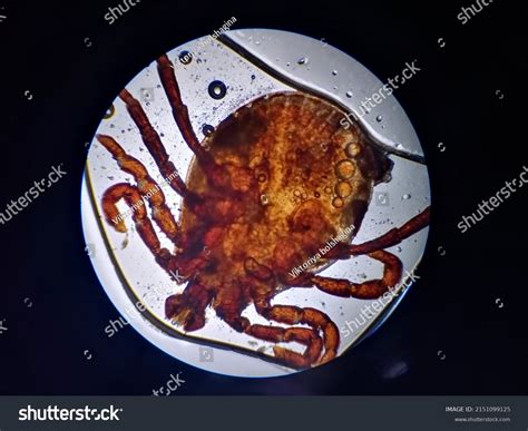 tick  microscope stock photo  shutterstock