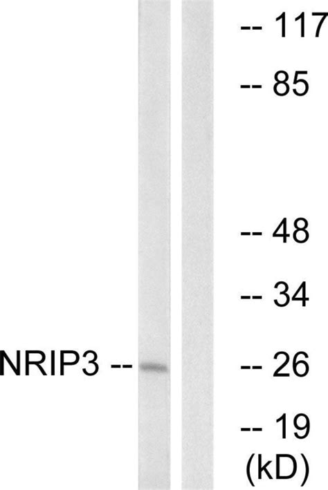 NRIP3 Polyclonal Antibody Invitrogen 100 μg Unconjugated Fisher