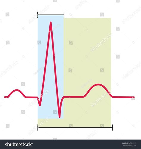 Electrocardiography Ecg Ekg Graph Heart Normal Stock Illustration ...