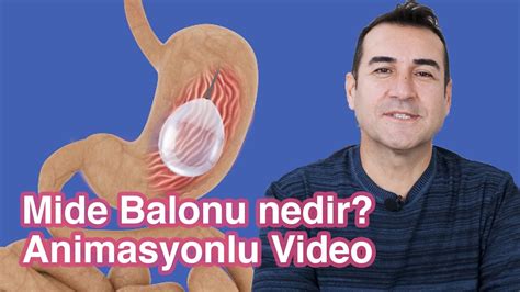 Mide Balonu Nedir Nas L Yap L R Animasyonlu Anlat M Youtube