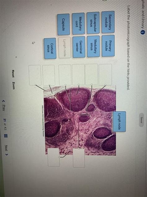 Solved Phatic And Urinary Saved Label The Photomicrograph Chegg