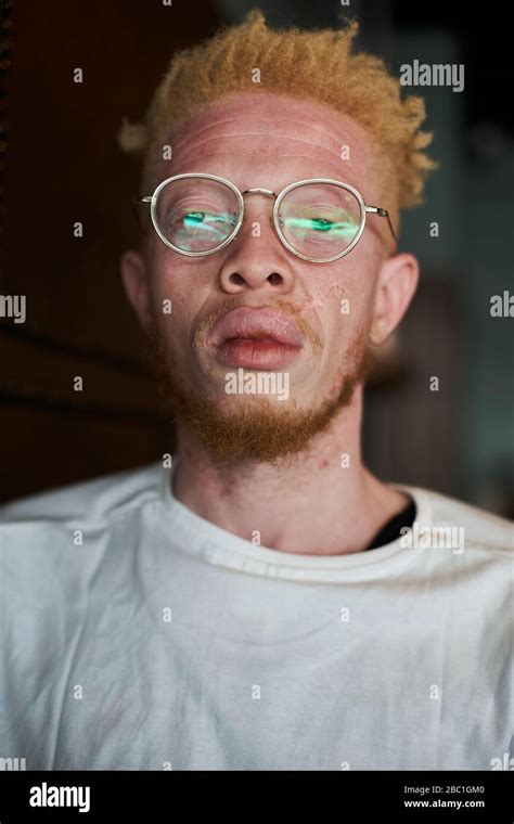 Albino man hi-res stock photography and images - Alamy