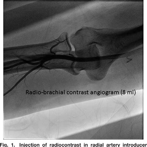 Figure 1 From VALVULAR AND STRUCTURAL HEART DISEASES Case Reports A