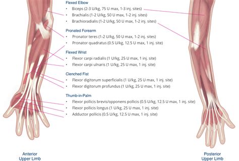 Upper Limb Spasticity