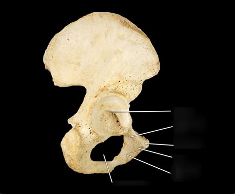 Lateral View Of Right Pubis Diagram Quizlet