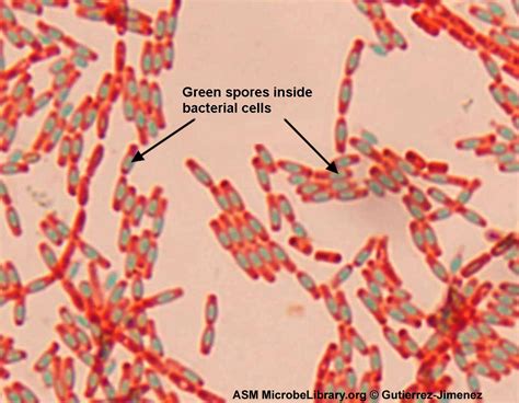 Bacillus Subtilis Gram Stain Bacillus Subtilis Bacillus Bacteria The