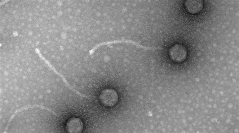 Fagos Los Virus Come Bacterias Para Combatir La Resistencia A Los