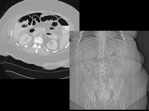 On Call Radiology Common Radiology Findings On Call And In The