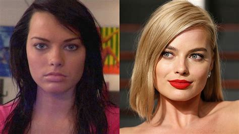 Margot Robbie Plastic Surgery Transformation: Before and After Photos ...