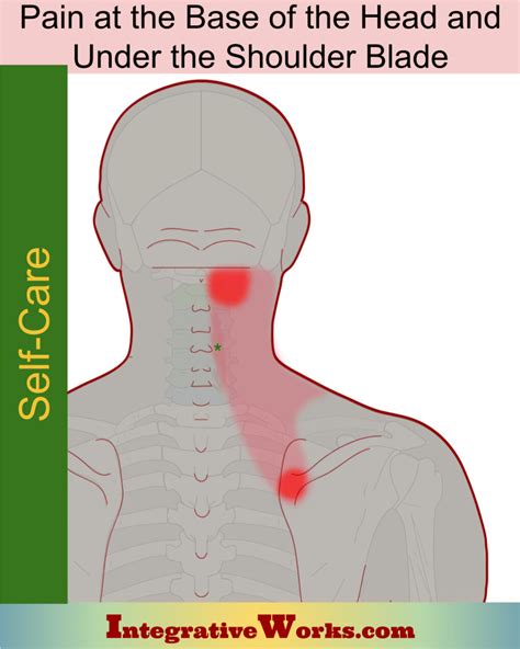 Stiff Neck Pain Patterns And Self Care Integrative Works