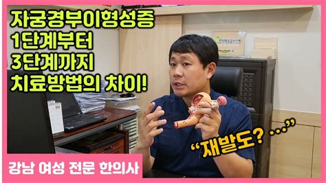 자궁경부이형성증 단계별 치료방법의 차이 1단계부터 3단계까지 Youtube